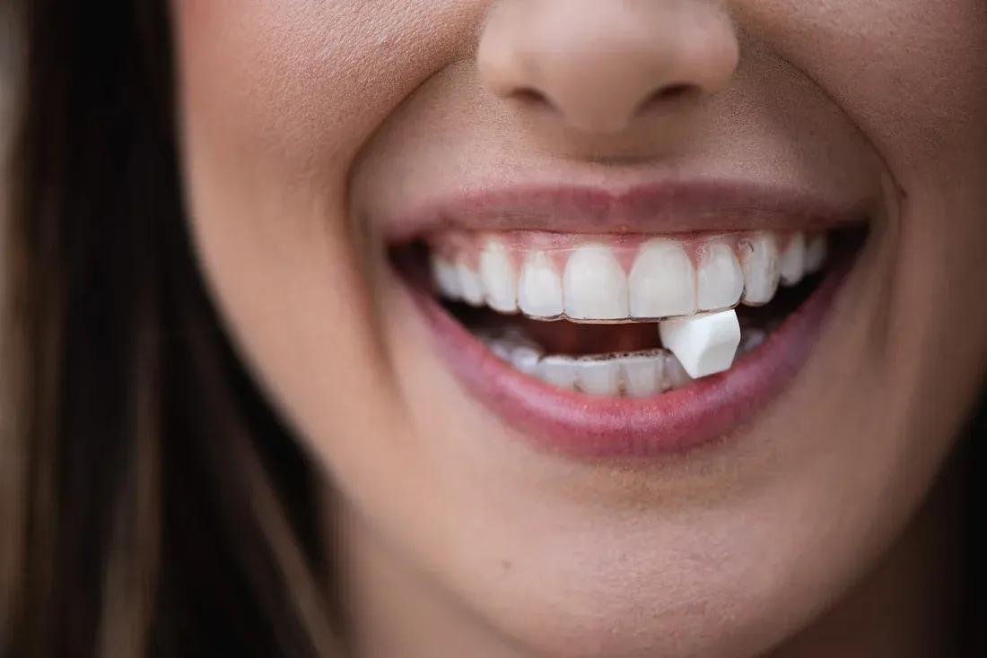 Qué son los chewies para ortodoncia invisible