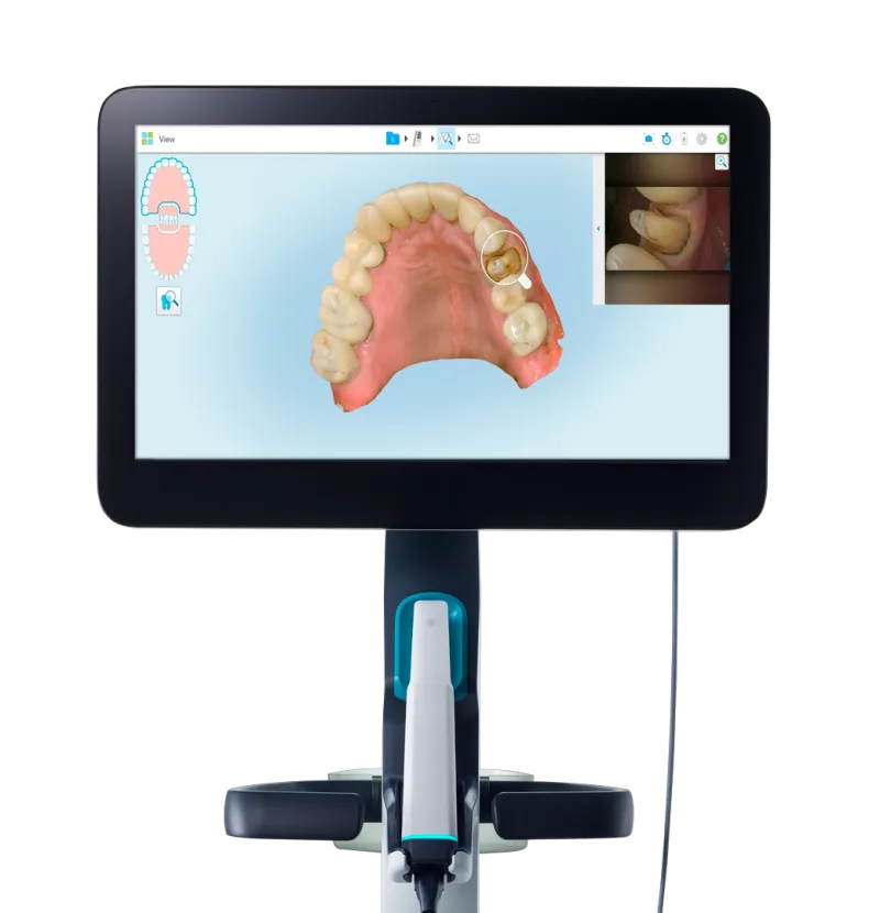 Escáner intraoral 3D